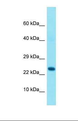 GRAP Antibody (N-Terminus)