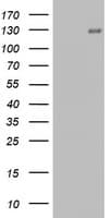 PR / Progesterone Receptor Antibody (aa1-298, clone OTI20A11)
