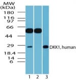 DKK1 Antibody (aa150-200)