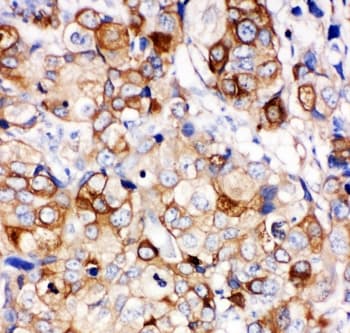 HSPB1 / HSP27 Antibody