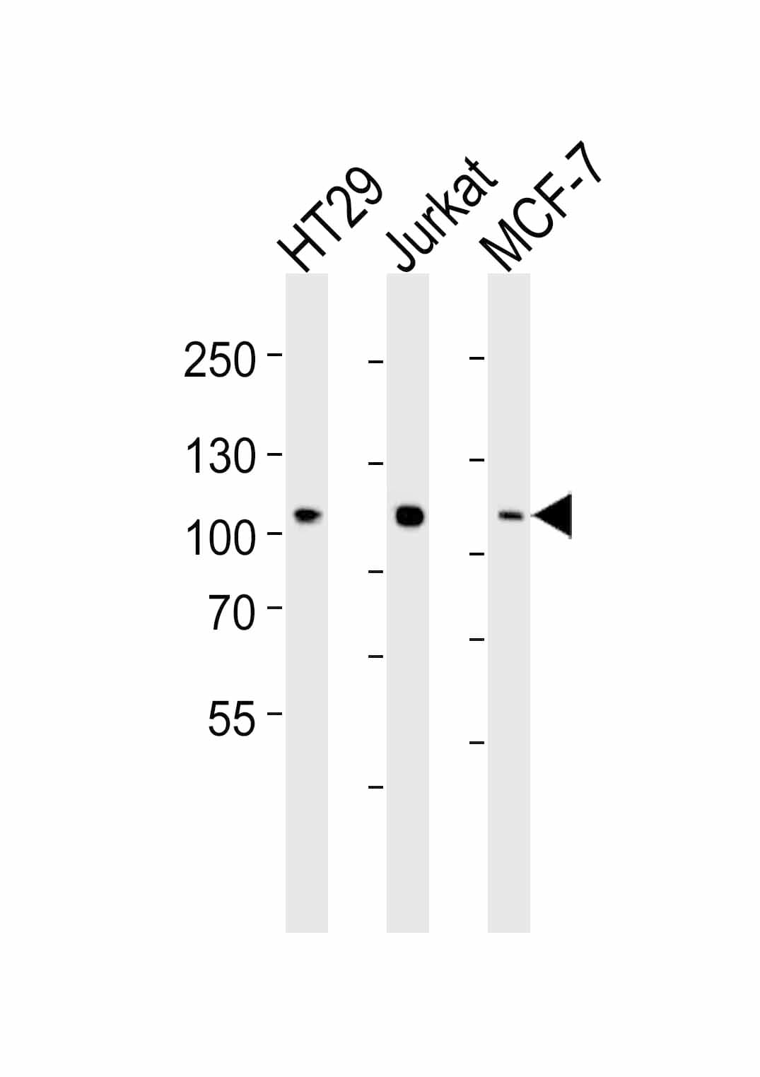 TPX2 Antibody (clone 19AT953.286.93)