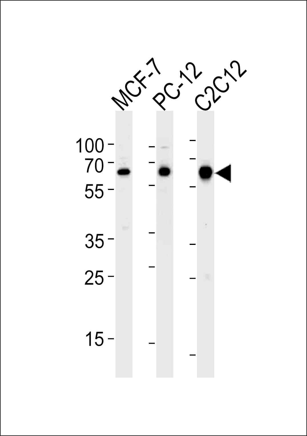 IHC-plus™ SRC Antibody (aa1-30)