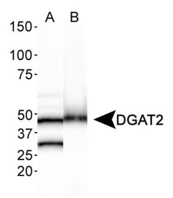 DGAT2 Antibody