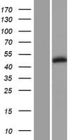 PIP4K2B Protein (Over-Expression Lysate Myc-DDK (Flag))