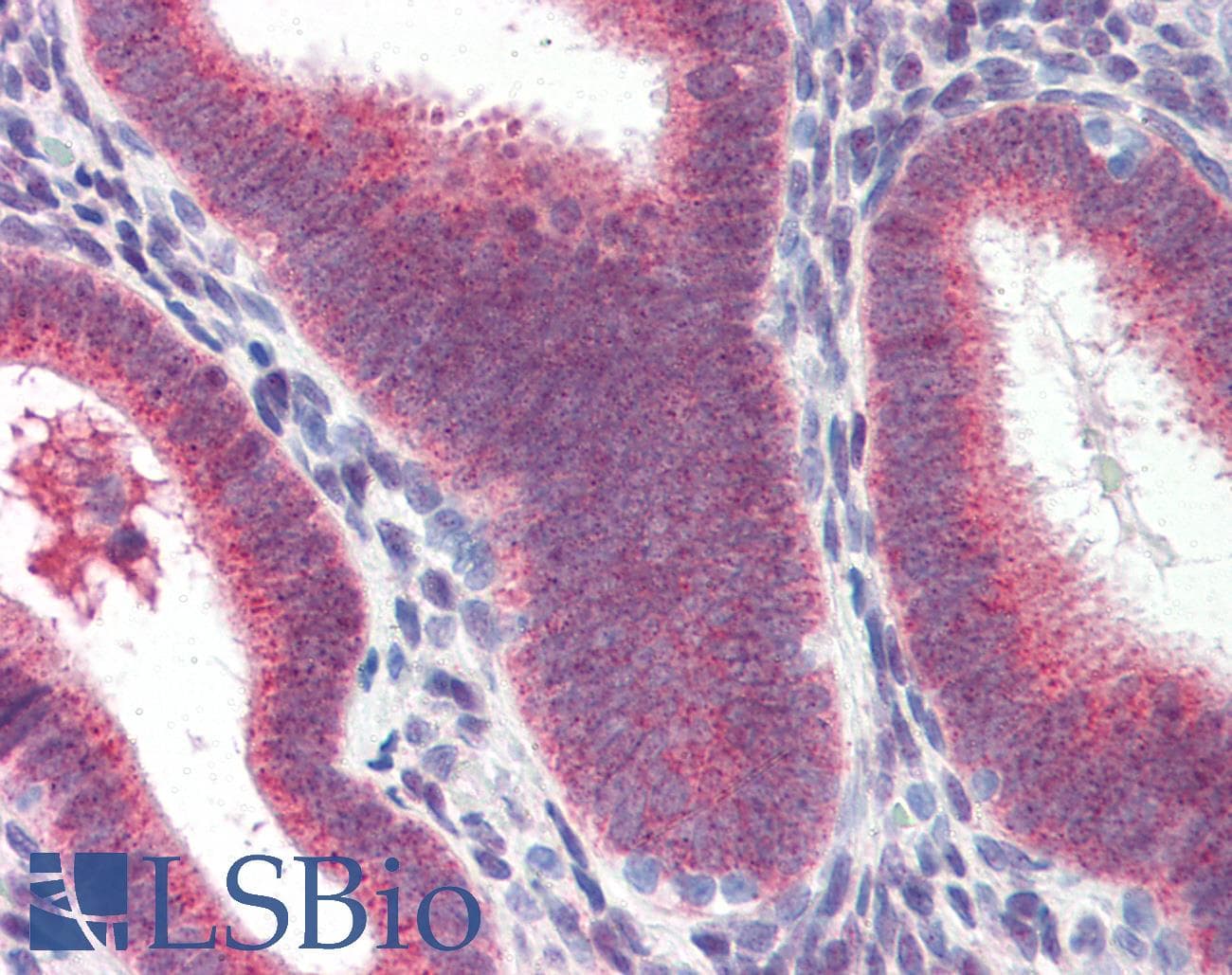 IHC-plus™ HSP70 / Heat Shock Protein 70 Antibody (aa1-641, clone 4E7)