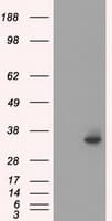 SRR / Serine Racemase Antibody (clone OTI7B6)
