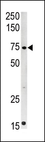 Polyclonal Rabbit anti-Human CPT2 Antibody (aa431-462, IF, WB)
