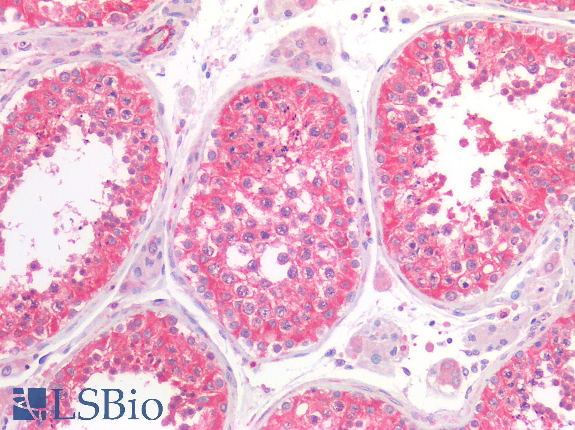 IHC-plus™ CYLD Antibody (clone 1667CT857.3.6.1)