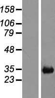 C25H / CH25H Protein (Over-Expression Lysate Myc-DDK (Flag))