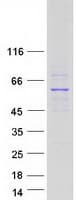 Human SNX4 Protein (Recombinant Myc-DDK (Flag))