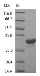 Human IGHG1 / IgG Protein (Recombinant 6His-SUMO, N-terminus)