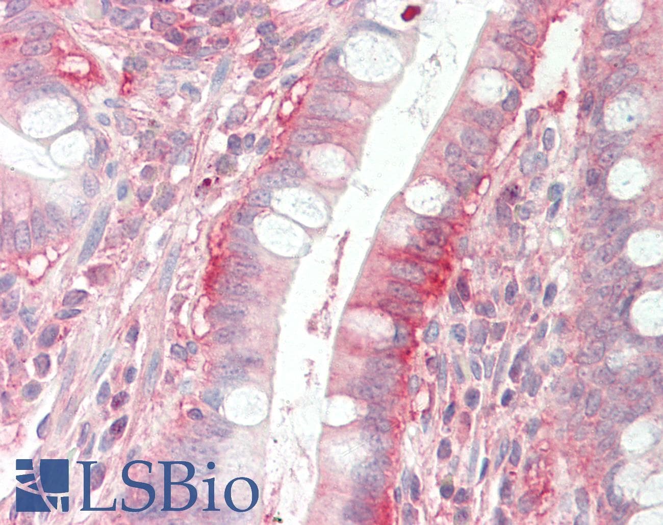 DPY19L1 Antibody (aa35-84)