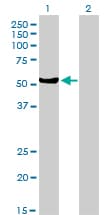 MUTYH / MYH Antibody (clone 4D10)