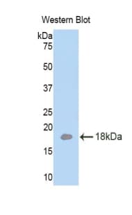 LAMA4 / Laminin Alpha 4 Antibody (aa102-234)