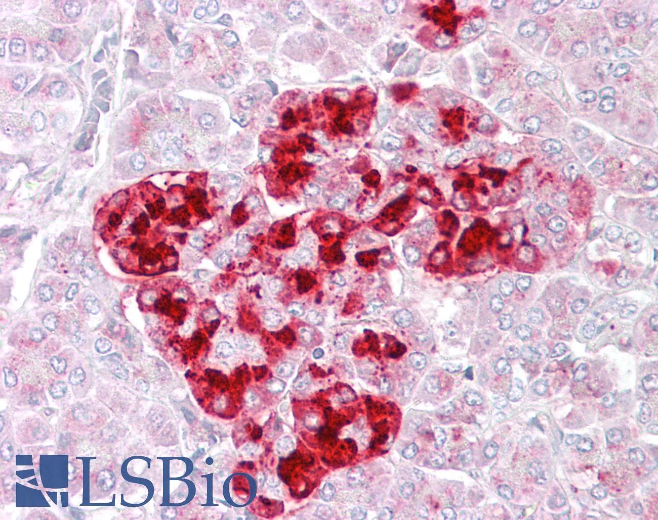 IHC-plus™ IGFBP7 / TAF Antibody (aa194-207)