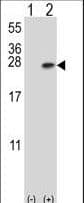 YWHAB / 14-3-3 Beta Antibody (aa217-246)