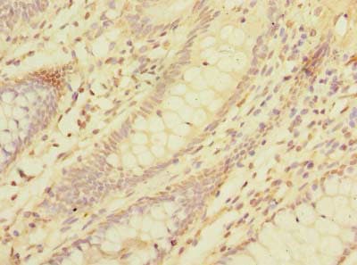 Polyclonal Rabbit anti-Human DAT1 / LMO3 Antibody (IHC, WB)