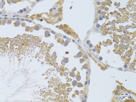 KIAA0652 / ATG13 Antibody