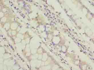 TCTA Antibody