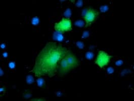 Thymidylate Kinase Antibody (clone OTI2B1, Carrier-free)