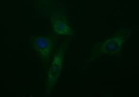 TUBB2A / Tubulin Beta 2A Antibody (clone OTI3E6)
