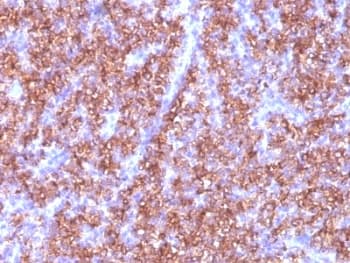 CHGA / Chromogranin A Antibody (clone CGA/413)