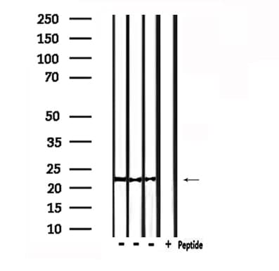 Polyclonal Rabbit anti-Human RHOC Antibody (IHC, WB)
