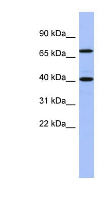 SLAIN2 Antibody (aa71-120)