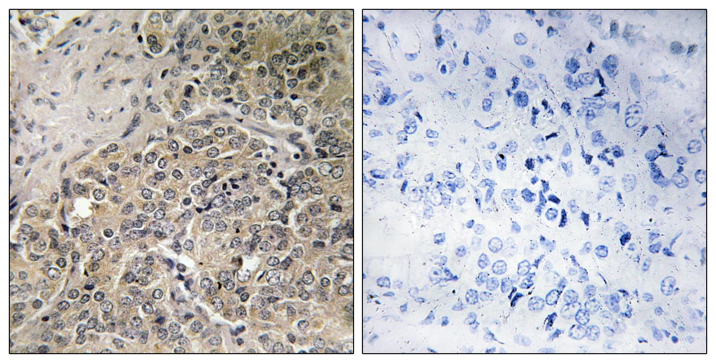 POTEH Antibody (aa401-450)