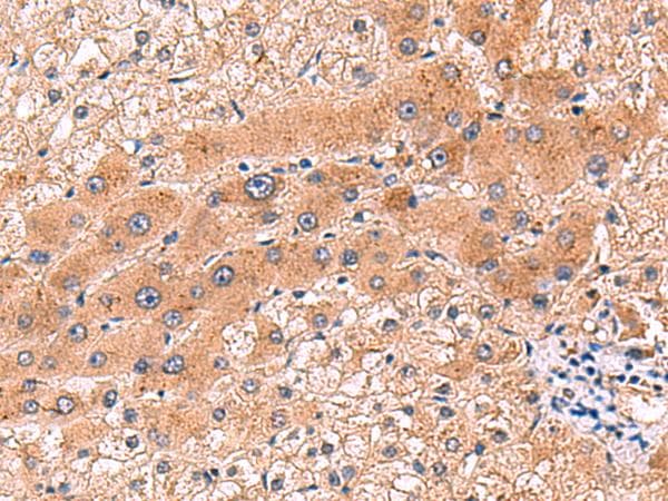 CCL13 / MCP4 Antibody