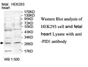 Polyclonal Rabbit anti-Human PID1 Antibody (aa83-250, IHC, WB)