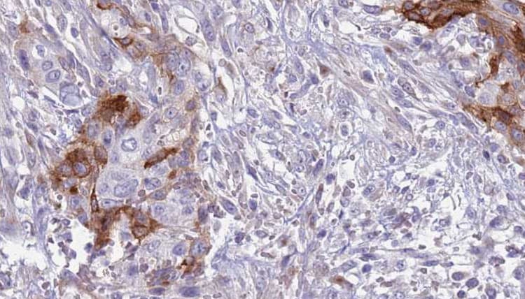 Polyclonal Rabbit anti-Human GP9 / CD42a Antibody (IHC, WB)