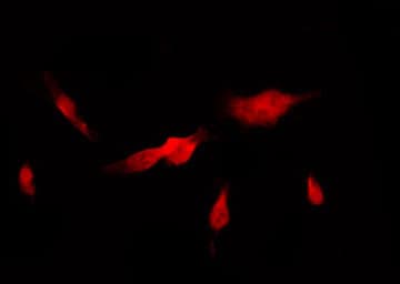KRT5 / CK5 / Cytokeratin 5 Antibody