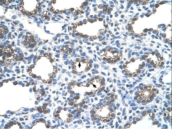 Polyclonal Rabbit anti-Human ANK1 / Ankyrin Antibody (C-Terminus, IHC, WB)