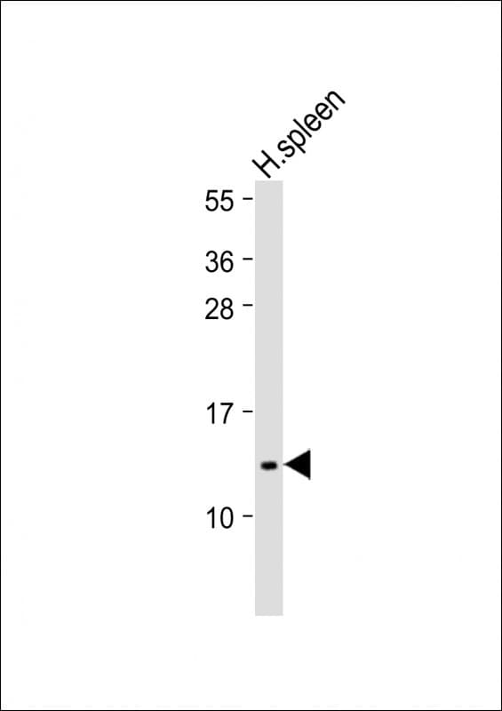 Polyclonal Rabbit anti-Human IFI27 / p27 Antibody (C-Terminus, WB)