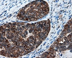 XRCC1 Antibody (clone OTI2D8)