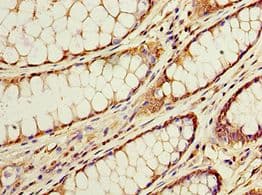 Polyclonal Rabbit anti-Human ACSM3 / SAH Antibody (aa387-586, IHC)