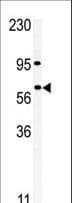 RIOK1 Antibody (aa522-551)