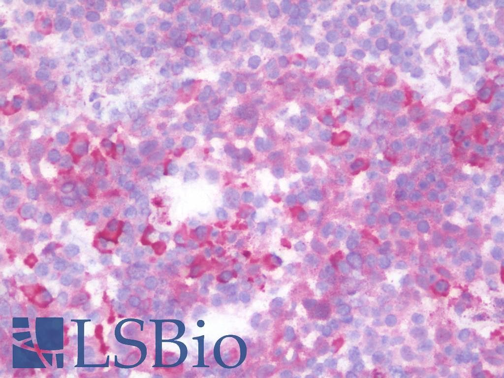 Polyclonal Rabbit anti-Human RPN2 / Ribophorin II Antibody (aa140-189, IHC, WB)