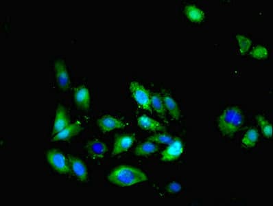 Polyclonal Rabbit anti-Human CX3CL1 / Fractalkine Antibody (WB)