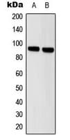 STAT5 A+B Antibody (Internal)