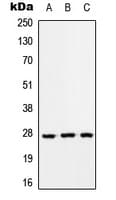 RAB33A Antibody (Internal)