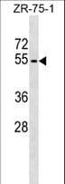 Polyclonal Rabbit anti-Human PLD4 / Phospholipase D4 Antibody (aa50-76, WB)