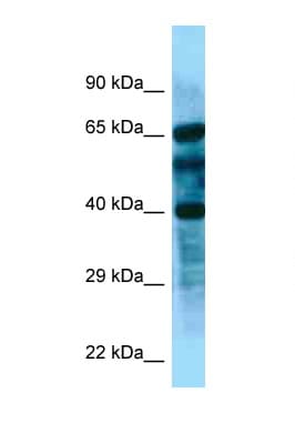 Polyclonal Rabbit anti-Human FBL8 / FBXL8 Antibody (aa83-132, WB)