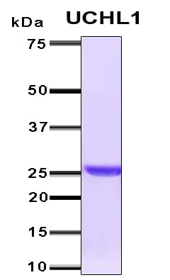 Human UCHL1 / PGP9.5 Protein (Recombinant 6His, N-terminus)