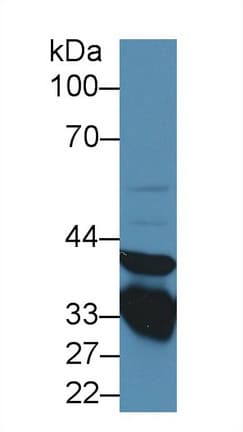 ANXA3 / Annexin A3 Antibody (aa19-154, PE)