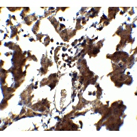 ZEB1 / AREB6 Antibody