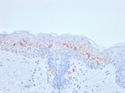 CD1A Antibody (clone rC1A/711, Azide-free, Carrier-free)