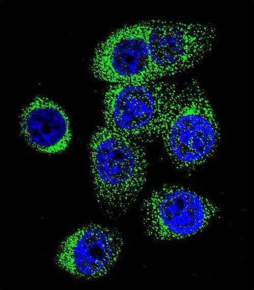 Polyclonal Rabbit anti-Human CASP12 / Caspase 12 Antibody (aa165-193, IHC, IF, WB)