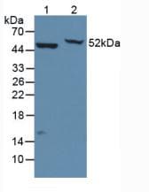 ENO2 / NSE Antibody (aa2-434)